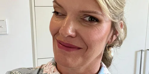 Mining Engineer's Facial Injury Journey Leads to Advocacy for Resilience